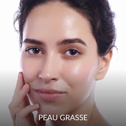 Peau grasse