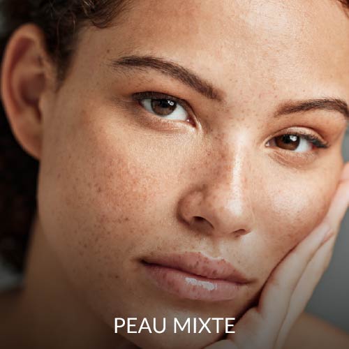 Peau mixte