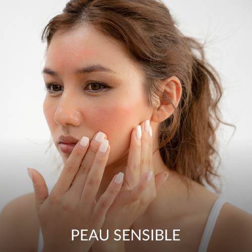 Peau sensible