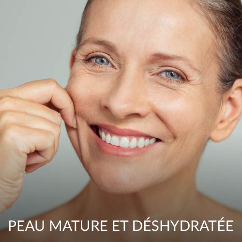 Peau mature et déshydratée