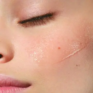 Lotion Tonique Purifiante Aux Extraits de Reine des Prés & Fleur de Safran - Peaux Mixtes à Grasses 200ml - Clarins - Soin - Visuel 3