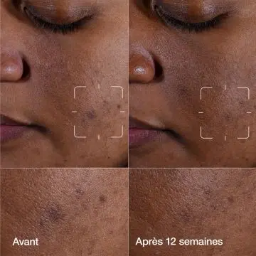 Even Better Clinical Sérum Illuminateur Anti-Taches 30ml - Clinique - Soin - Visuel 2
