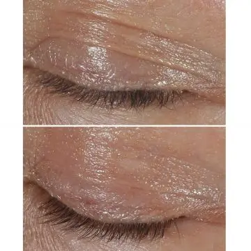 Clinique Smart Clinical Repair - Crème Yeux Correction Rides Correction Rides 15ml - Clinique - Soin - Visuel 3