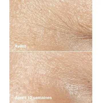 Smart Clinical Repair Crème riche correctrice anti-rides 50ml