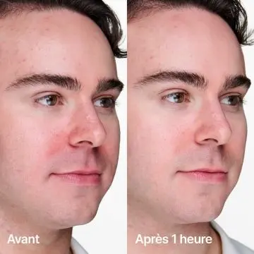 Anti-Blemish Solutions Clinical Gel Anti-Imperfections+ 20ml - Clinique - Soin - Visuel 3