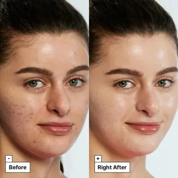 Cicapair Traitement Correcteur de Couleur 50ml - DR JART - Soin - Visuel 2