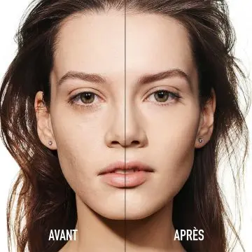 Dior Forever Skin Correct Correcteur Anti-cerne Haute Couvrance 1,5 N Neutral - Dior - Maquillage - Visuel 2