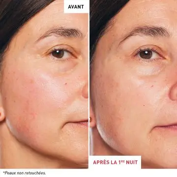 Skin Therapy Huile de Nuit Multi-Perfectrice 30ml - Erborian - Soin - Visuel 3