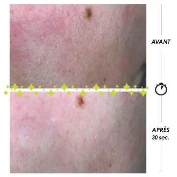 Pschitt Magique Micropeeling Visage 100ml - Garancia - Soin - Visuel 2 Pschitt Magique Micropeeling Visage 100ml - Garancia - Soin - Visuel 2