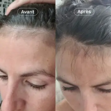 Coffret Cheveux Omum & Chou² Shampoing Ma Bulle Douceur, Complément Alimentaire Mon Coup de Pousse & Chouchou Satin  - Omum - Soin - Visuel 4 Coffret Cheveux Omum & Chou² Shampoing Ma Bulle Douceur, Complément Alimentaire Mon Coup de Pousse & Chouchou Satin  - Omum - Soin - Visuel 4