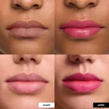 Lip Rehab Serum Oil Huile à Lèvres Kissed - WONDERSKIN - Maquillage - Visuel 2