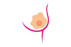 Une modification du mamelon ou de l’aréole (zone qui entoure le mamelon) : rétraction, changement de coloration, suintement ou écoulement